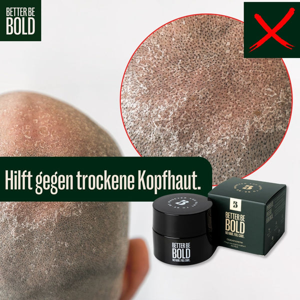 NO HAIR. FULL CARE. BALD CREAM. Glatzenpflege BetterBeBold